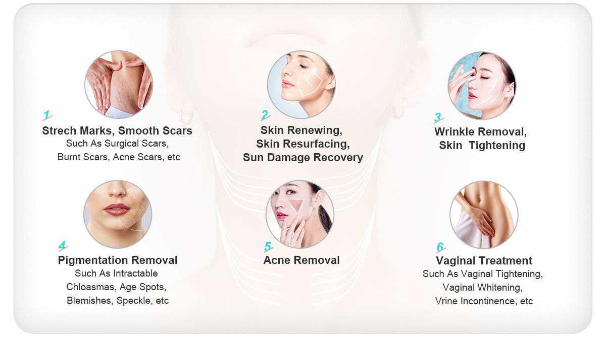 Professional CO2 Fractional Laser Machine